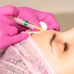 Dysport vs Botox