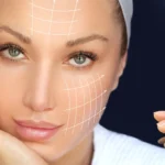 Botox vs Fillers