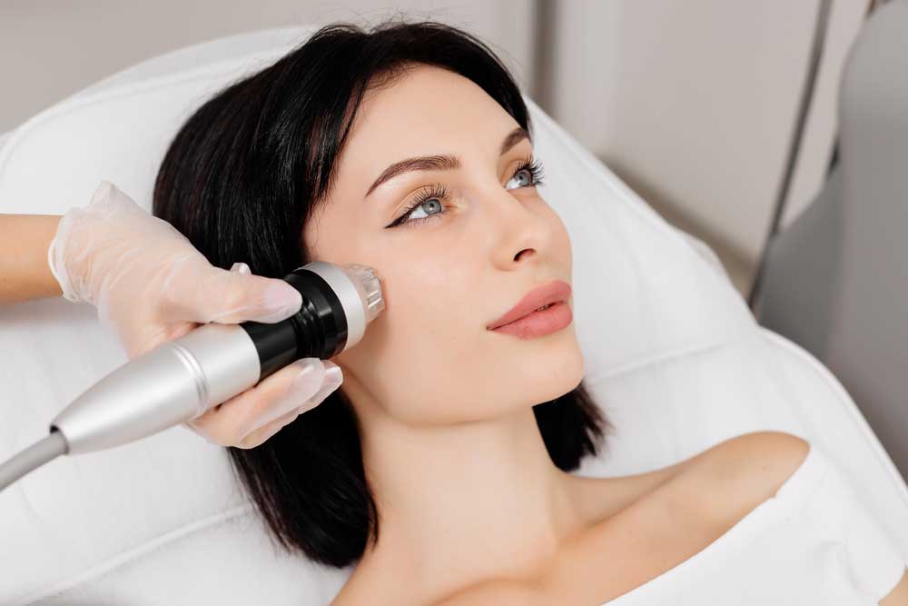 rf microneedling sylfirm x redlands ca