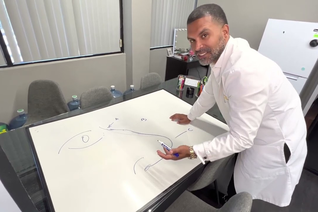 non surgical nose job how we do it uai